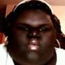 Obesity