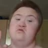 epileptickid