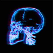 X Ray