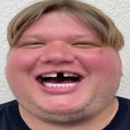 p1mple