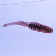 echinococcus
