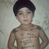 McPox