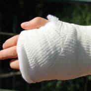 i play with broken wrist