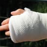 i play with broken wrist