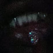 alprazolam