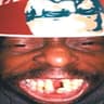 Mokambe