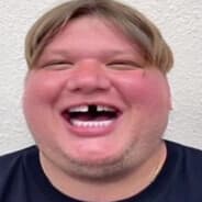 D1L