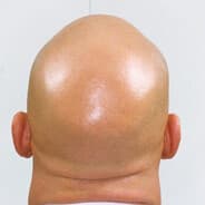 chad
