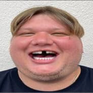 podsad