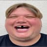podsad
