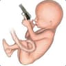 Cletus The Fetus
