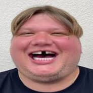 d1mple