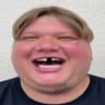 d1mple