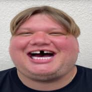 s0mple