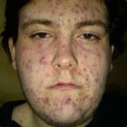 G2 torbenbruhns