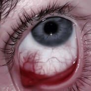 Je t'ai arraché les yeux