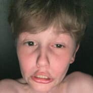 YT